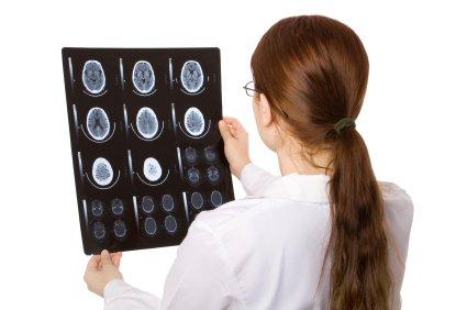 Brain scan 1