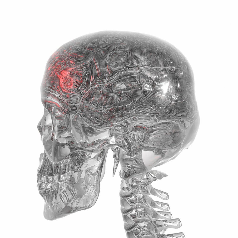 Headache_MedLIB_headache