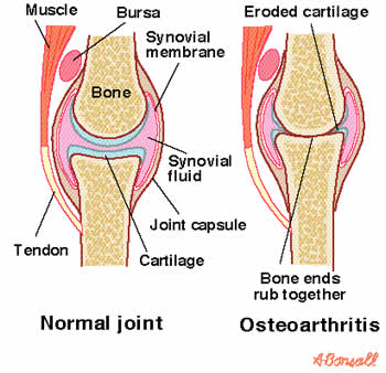 What are some natural treatments for knee synovitis?